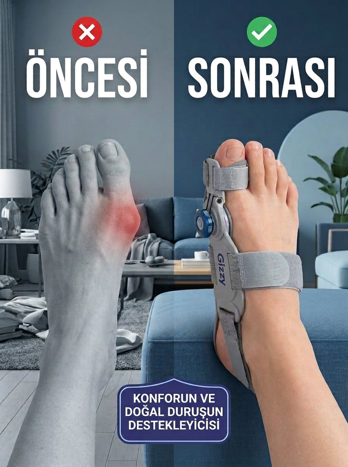 Gizzy Ergonomik Ayak Parmak Konfor Aparatı